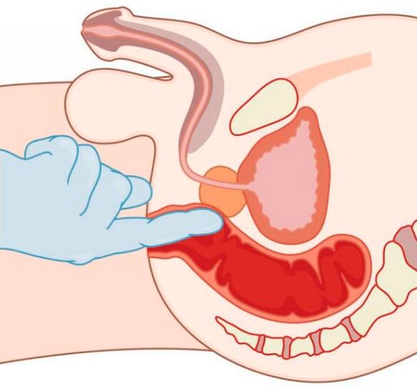 G-spot stimulation in men through the anus